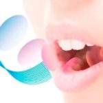 若年性歯周病（侵襲性歯周炎）について