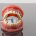 歯科治療とオゾンの関係