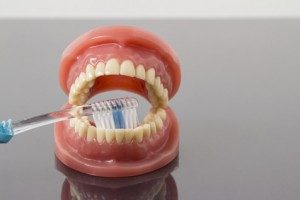 歯科治療とオゾンの関係