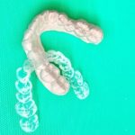 スポーツ用マウスピースはなぜ必要？