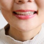 口元が出ている?~ロゴボってしっていますか?~